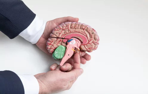 Adult Brain Tumour Specialist in Sydney