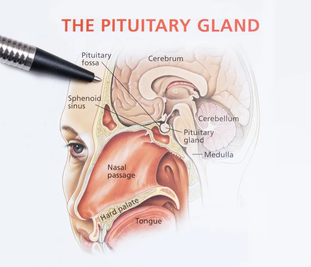 Pituitary Tumours