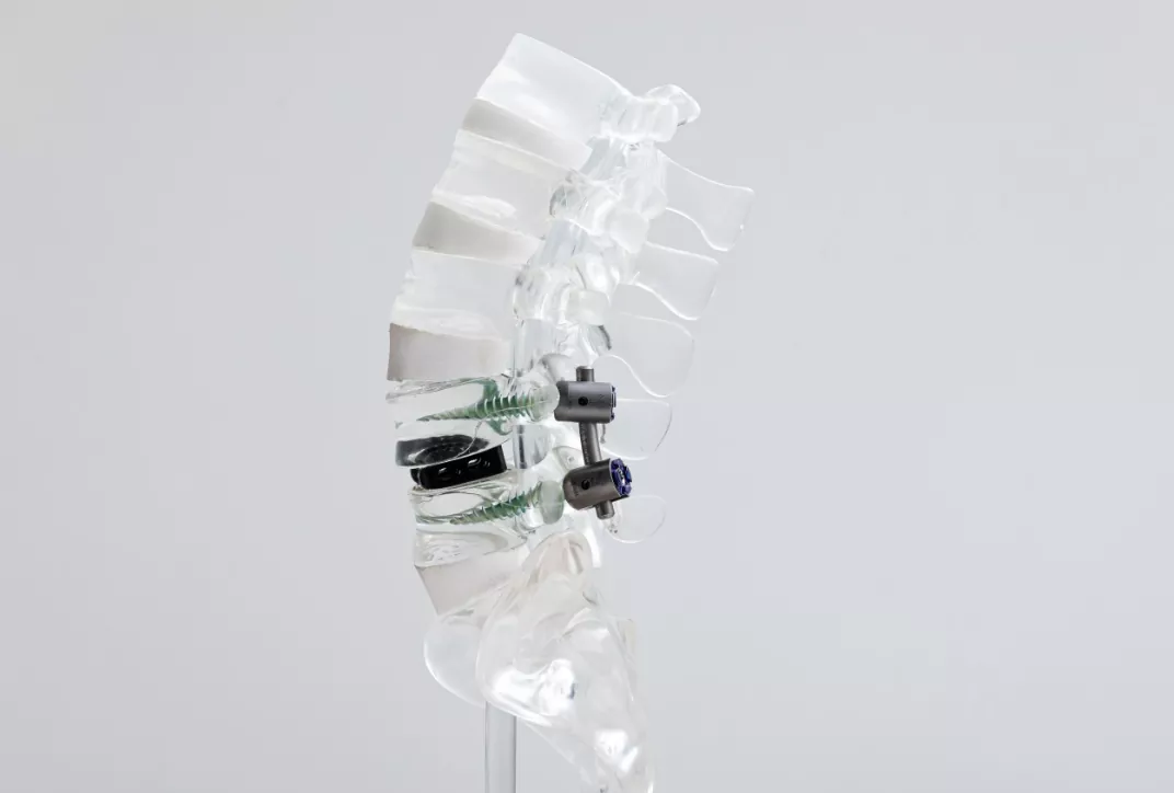 lumbar spine structure about the lumbar spine professor brian owler